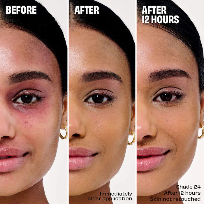 Benefit Foundation